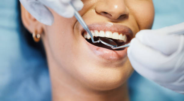 Best Broken or Cracked Tooth Emergency Dentist in West Jordan, UT